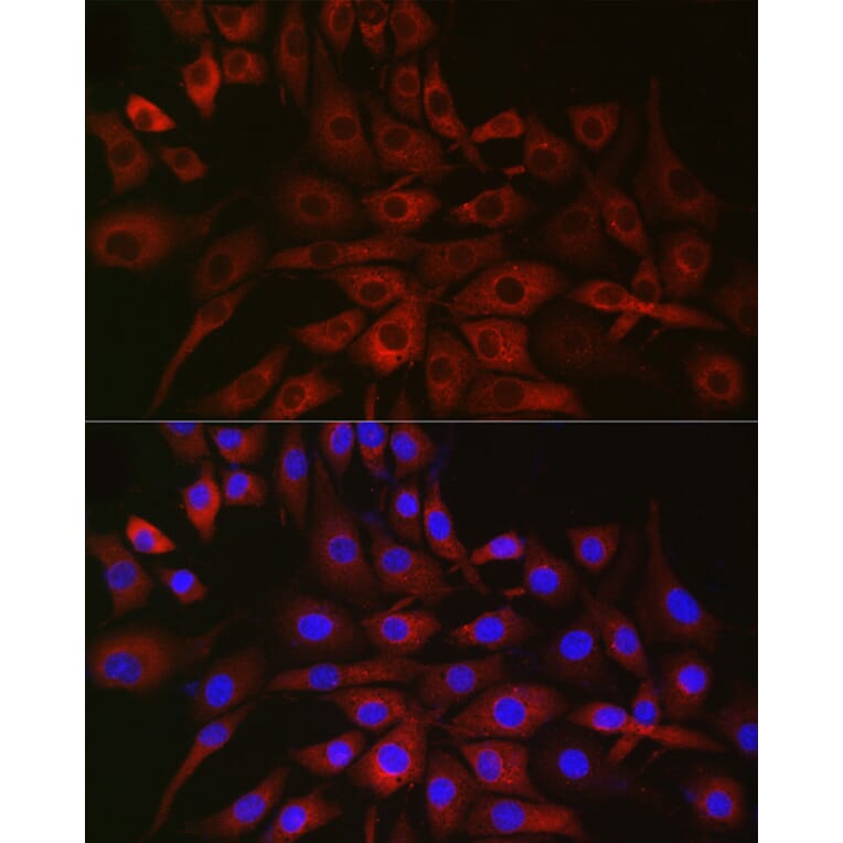 Immunofluorescence - Anti-P4HA2 Antibody (A14543) - Antibodies.com