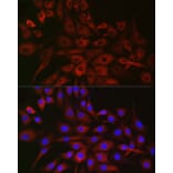 Immunofluorescence - Anti-P4HA2 Antibody (A14543) - Antibodies.com
