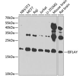 Western Blot - Anti-EIF1AY Antibody (A14544) - Antibodies.com