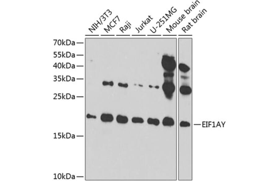 Western Blot - Anti-EIF1AY Antibody (A14544) - Antibodies.com