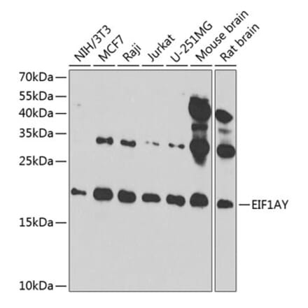 Western Blot - Anti-EIF1AY Antibody (A14544) - Antibodies.com