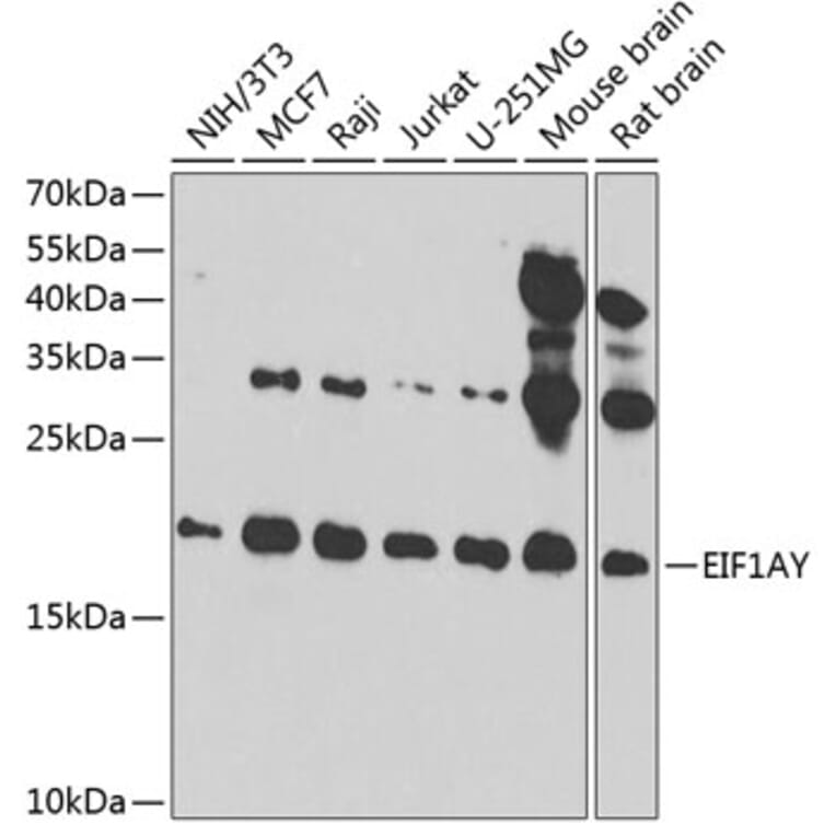 Western Blot - Anti-EIF1AY Antibody (A14544) - Antibodies.com