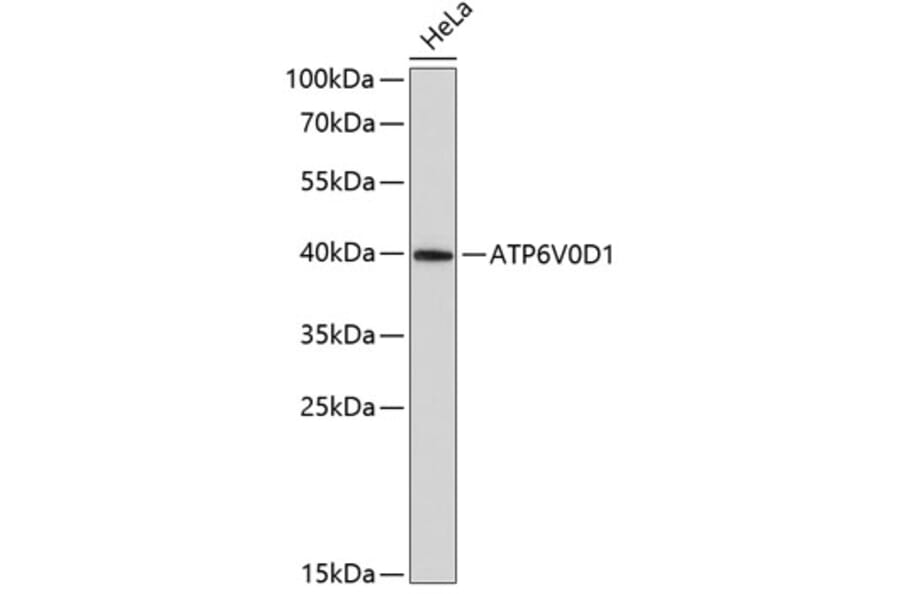 Western Blot - Anti-ATP6V0D1 / P39 Antibody (A14545) - Antibodies.com