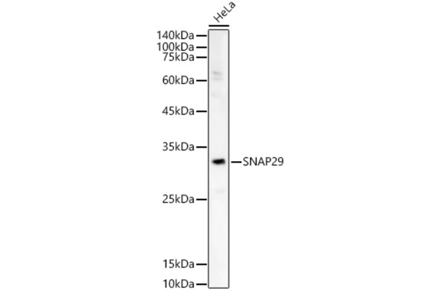 Western Blot - Anti-SNAP29 Antibody (A14546) - Antibodies.com
