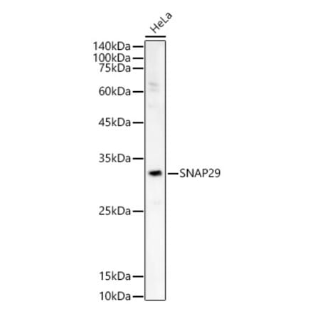 Western Blot - Anti-SNAP29 Antibody (A14546) - Antibodies.com