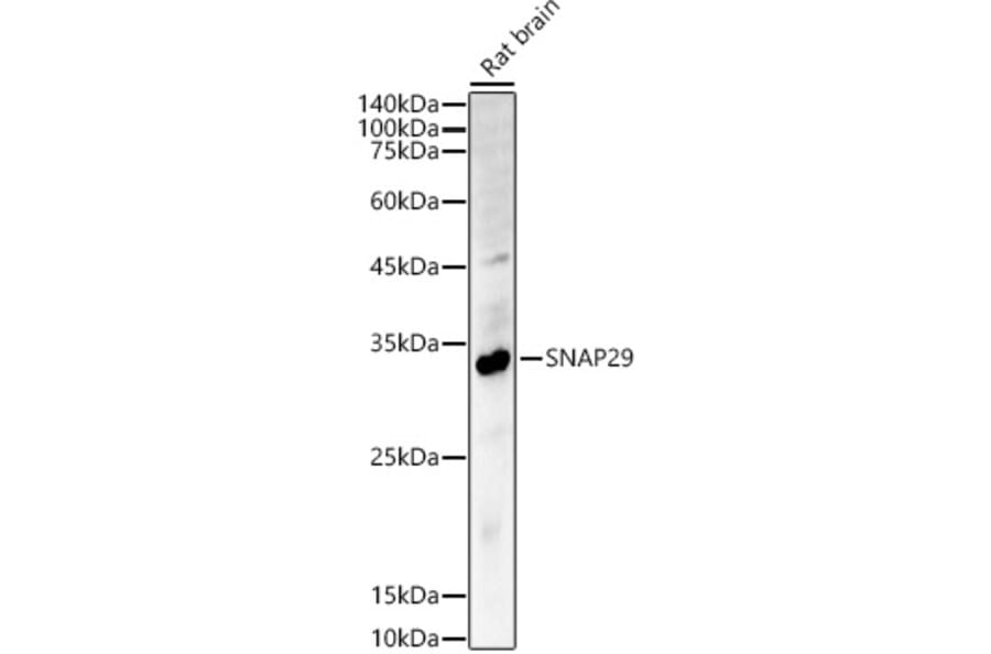 Western Blot - Anti-SNAP29 Antibody (A14546) - Antibodies.com
