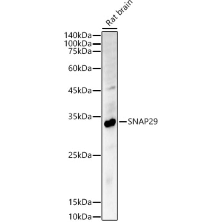 Western Blot - Anti-SNAP29 Antibody (A14546) - Antibodies.com