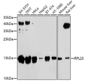 Western Blot - Anti-RPL23 Antibody (A14547) - Antibodies.com