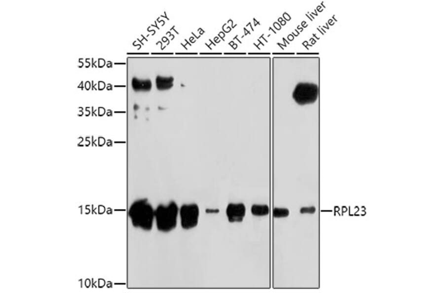 Western Blot - Anti-RPL23 Antibody (A14547) - Antibodies.com