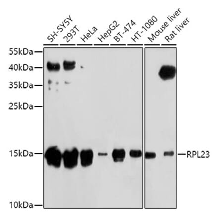 Western Blot - Anti-RPL23 Antibody (A14547) - Antibodies.com