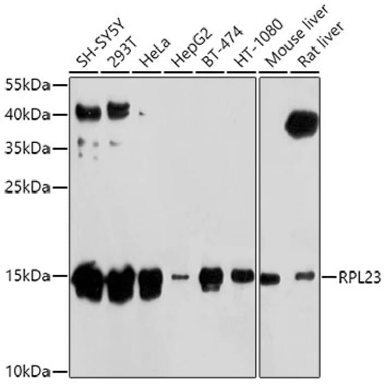 Western Blot - Anti-RPL23 Antibody (A14547) - Antibodies.com