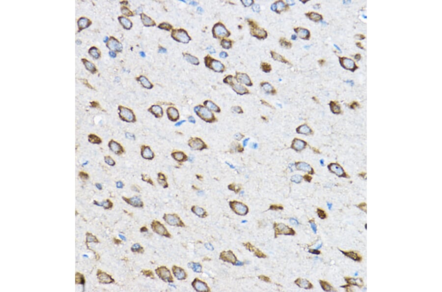 Immunohistochemistry - Anti-RPL23 Antibody (A14547) - Antibodies.com