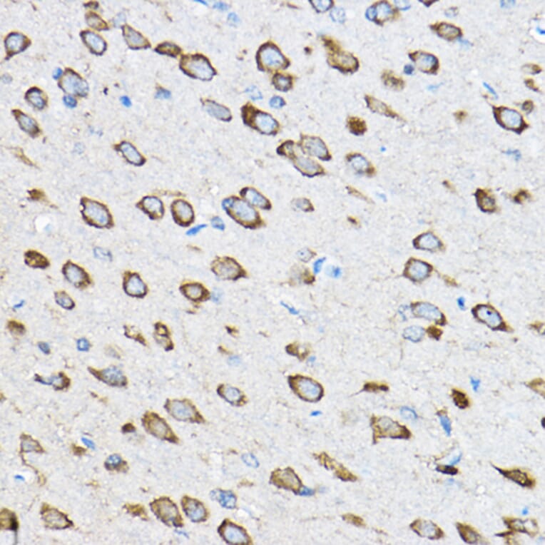 Immunohistochemistry - Anti-RPL23 Antibody (A14547) - Antibodies.com