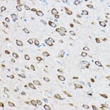 Immunohistochemistry - Anti-RPL23 Antibody (A14547) - Antibodies.com