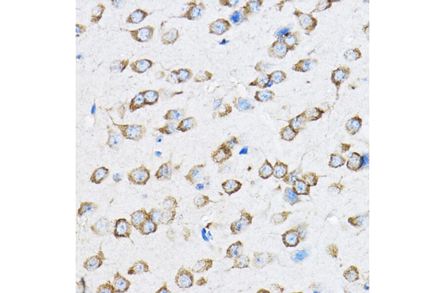 Immunohistochemistry - Anti-RPL23 Antibody (A14547) - Antibodies.com
