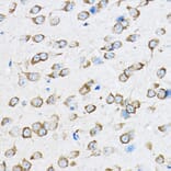 Immunohistochemistry - Anti-RPL23 Antibody (A14547) - Antibodies.com