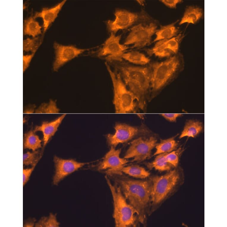 Immunofluorescence - Anti-RPL23 Antibody (A14547) - Antibodies.com