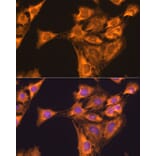 Immunofluorescence - Anti-RPL23 Antibody (A14547) - Antibodies.com