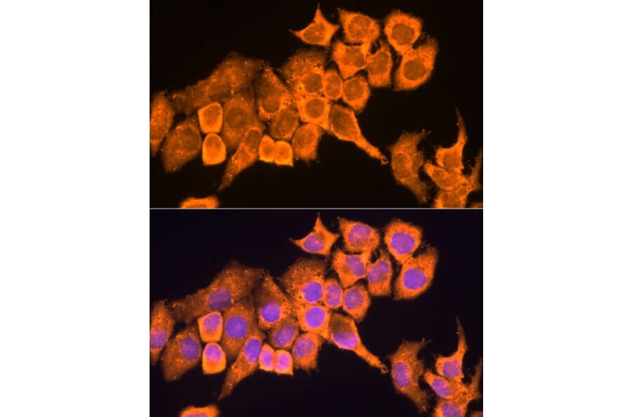 Immunofluorescence - Anti-RPL23 Antibody (A14547) - Antibodies.com