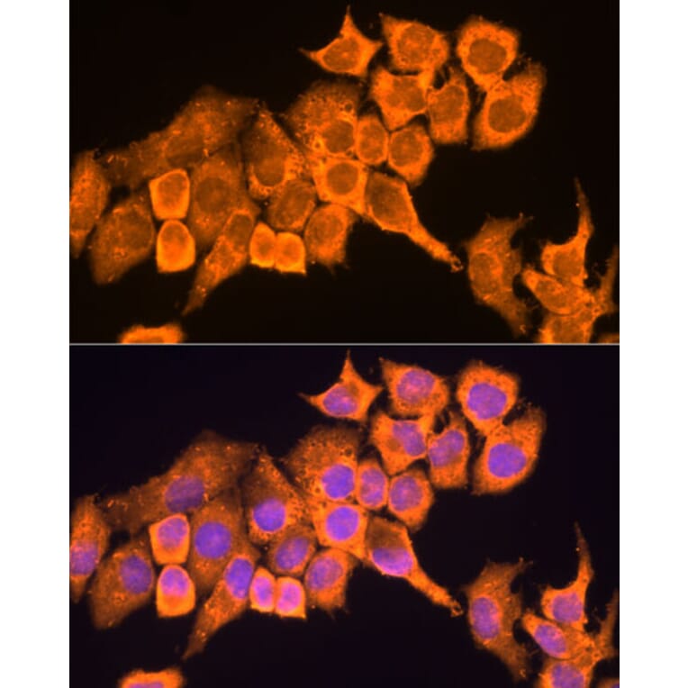 Immunofluorescence - Anti-RPL23 Antibody (A14547) - Antibodies.com