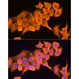 Immunofluorescence - Anti-RPL23 Antibody (A14547) - Antibodies.com