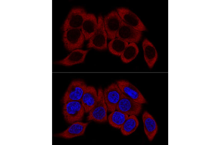 Immunofluorescence - Anti-RPL23 Antibody (A14547) - Antibodies.com