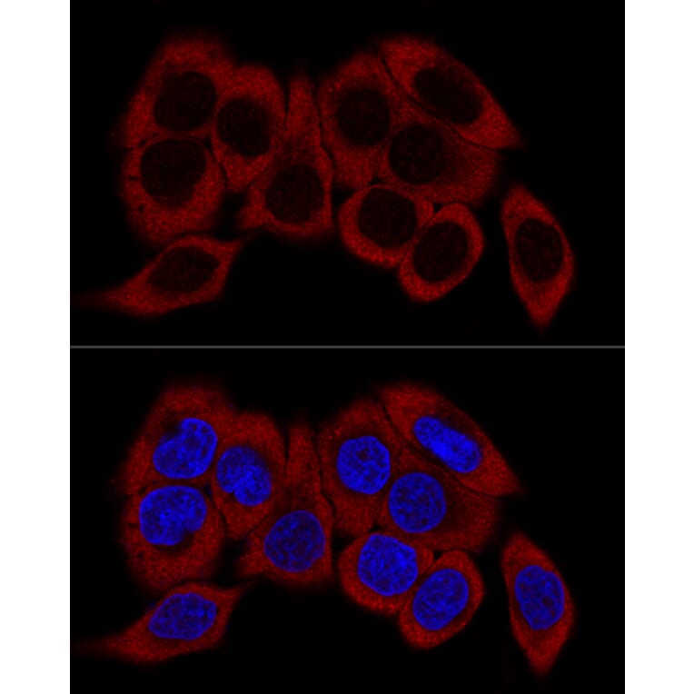 Immunofluorescence - Anti-RPL23 Antibody (A14547) - Antibodies.com