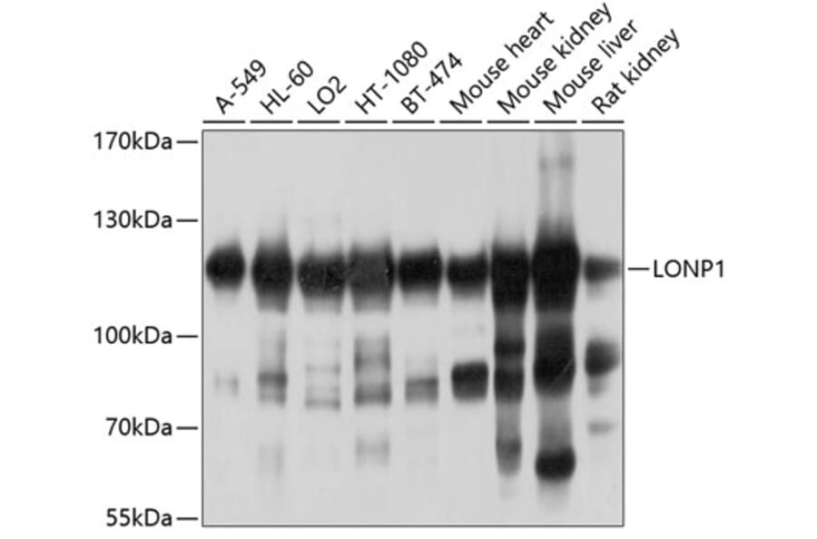 Western Blot - Anti-LONP1/Lon Antibody (A14548) - Antibodies.com