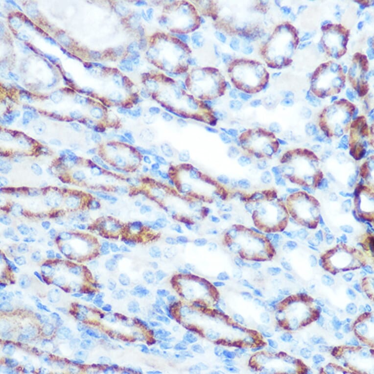 Immunohistochemistry - Anti-LONP1/Lon Antibody (A14548) - Antibodies.com