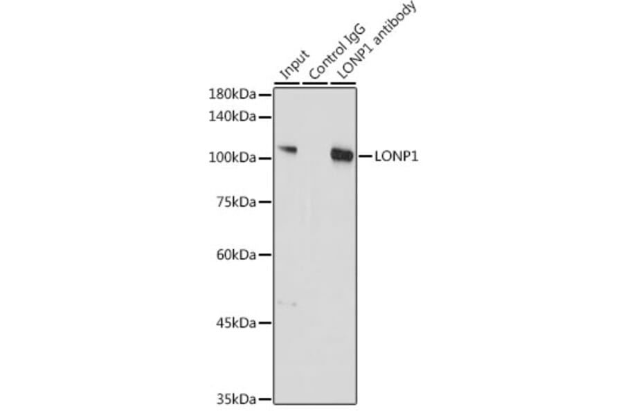 Western Blot - Anti-LONP1/Lon Antibody (A14548) - Antibodies.com