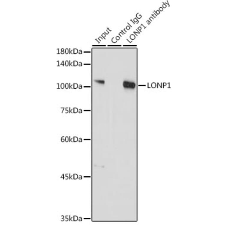 Western Blot - Anti-LONP1/Lon Antibody (A14548) - Antibodies.com