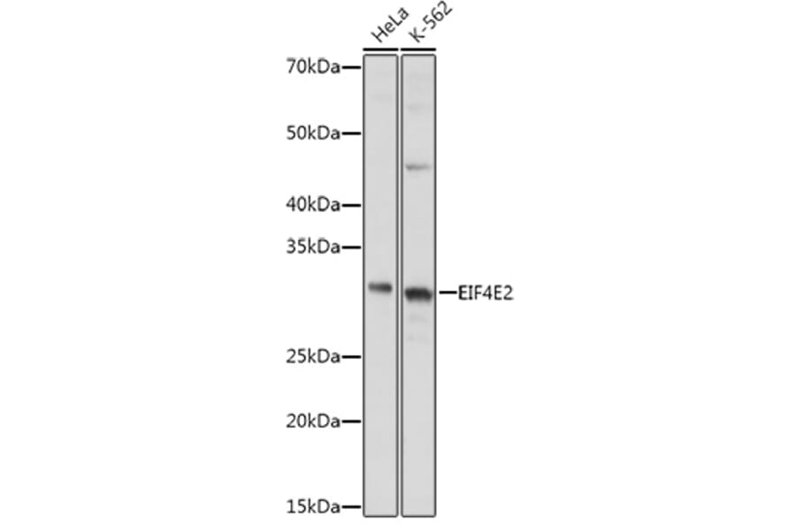 Western Blot - Anti-EIF4E2 Antibody (A14549) - Antibodies.com