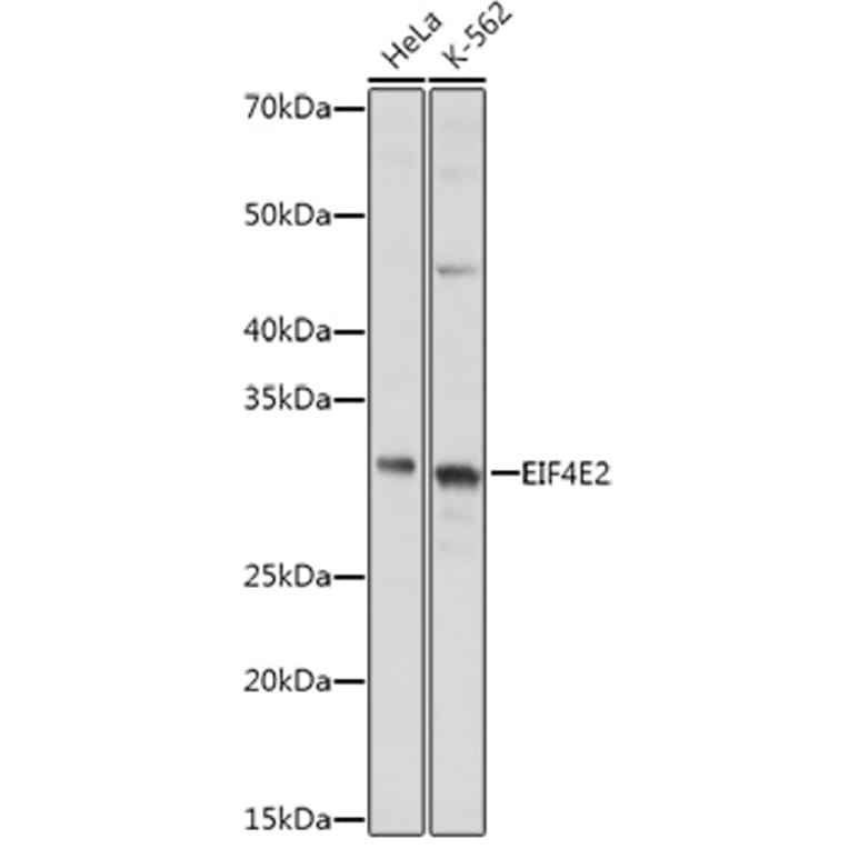 Western Blot - Anti-EIF4E2 Antibody (A14549) - Antibodies.com