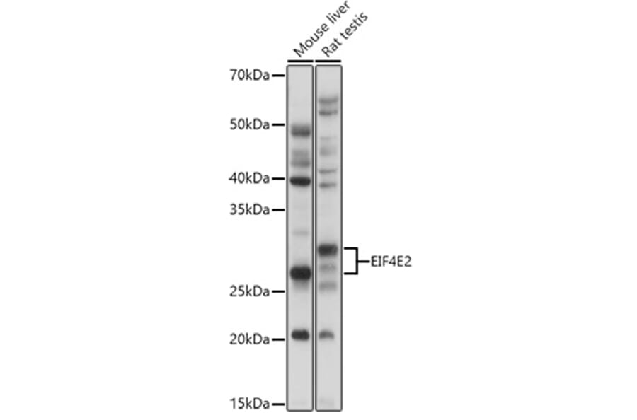 Western Blot - Anti-EIF4E2 Antibody (A14549) - Antibodies.com