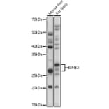 Western Blot - Anti-EIF4E2 Antibody (A14549) - Antibodies.com