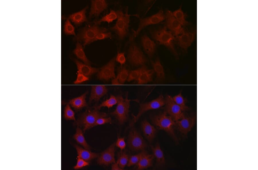 Immunofluorescence - Anti-EIF4E2 Antibody (A14549) - Antibodies.com