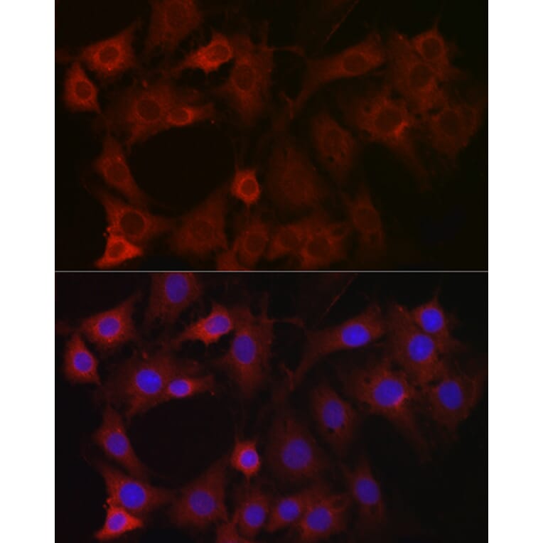 Immunofluorescence - Anti-EIF4E2 Antibody (A14549) - Antibodies.com