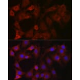 Immunofluorescence - Anti-EIF4E2 Antibody (A14549) - Antibodies.com