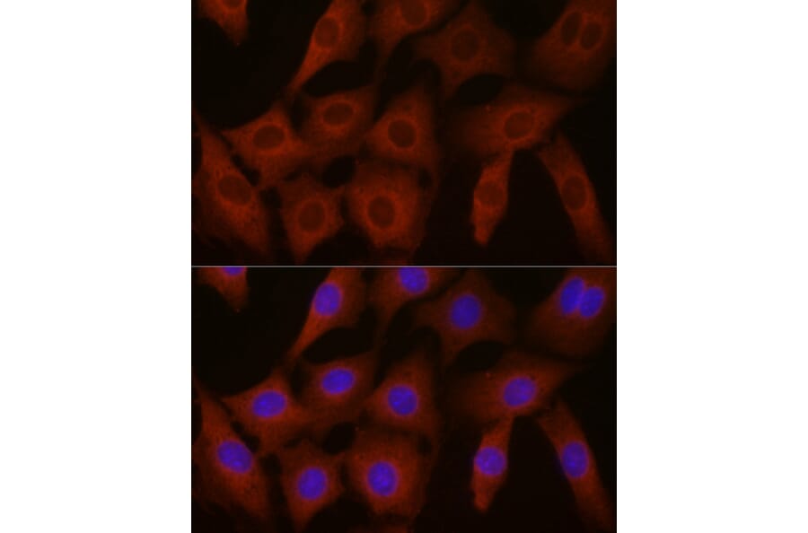 Immunofluorescence - Anti-EIF4E2 Antibody (A14549) - Antibodies.com