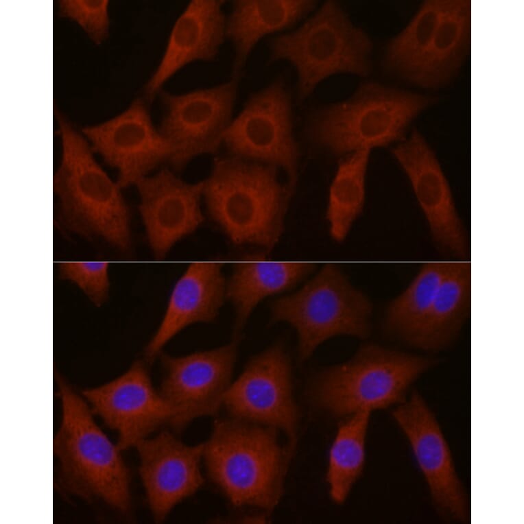 Immunofluorescence - Anti-EIF4E2 Antibody (A14549) - Antibodies.com