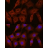 Immunofluorescence - Anti-EIF4E2 Antibody (A14549) - Antibodies.com