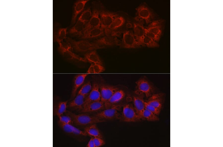 Immunofluorescence - Anti-EIF4E2 Antibody (A14549) - Antibodies.com