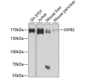 Western Blot - Anti-SAF-B2 Antibody (A14550) - Antibodies.com