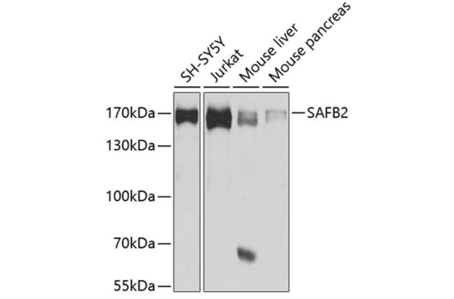 Western Blot - Anti-SAF-B2 Antibody (A14550) - Antibodies.com