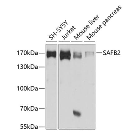 Western Blot - Anti-SAF-B2 Antibody (A14550) - Antibodies.com