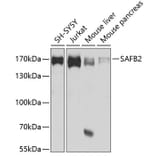 Western Blot - Anti-SAF-B2 Antibody (A14550) - Antibodies.com