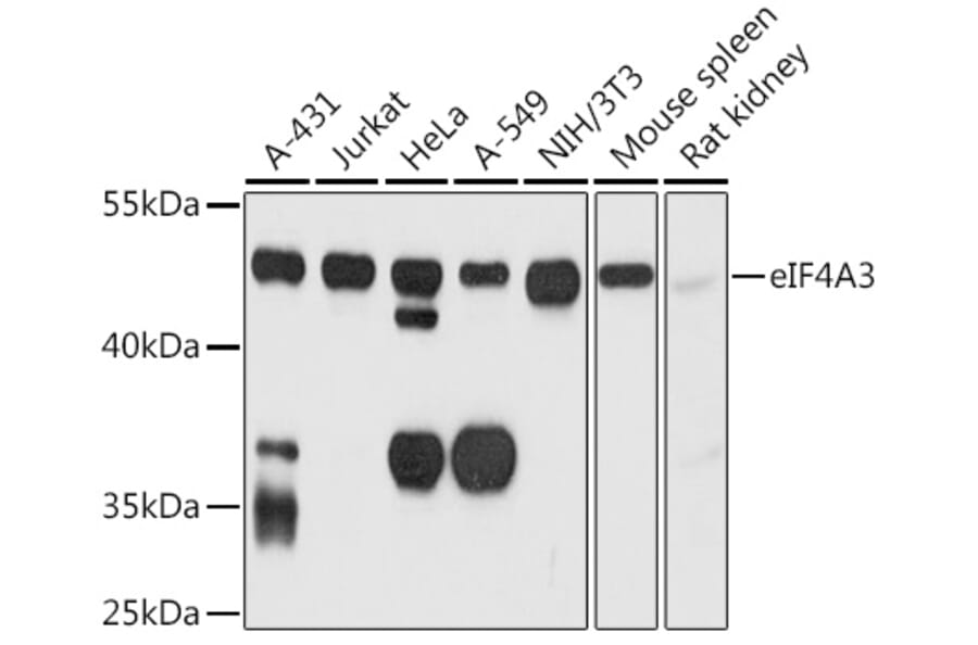 Western Blot - Anti-eIF4A3 Antibody (A14551) - Antibodies.com