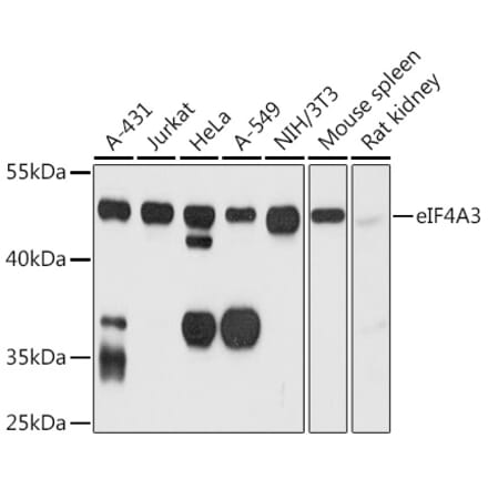 Western Blot - Anti-eIF4A3 Antibody (A14551) - Antibodies.com