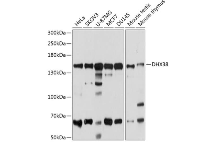 Western Blot - Anti-PRP16 Antibody (A14552) - Antibodies.com