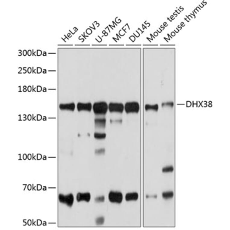 Western Blot - Anti-PRP16 Antibody (A14552) - Antibodies.com